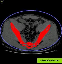 Step 2. Segmentation