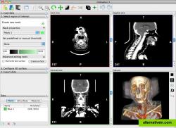 Multislice view and Volume Rendering