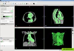 Segmentation and 3D mesh