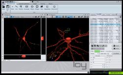 Main graphical interfafce, with a synchronised 2D and 3D view of the same data (a fluorescent neuron in 3D)